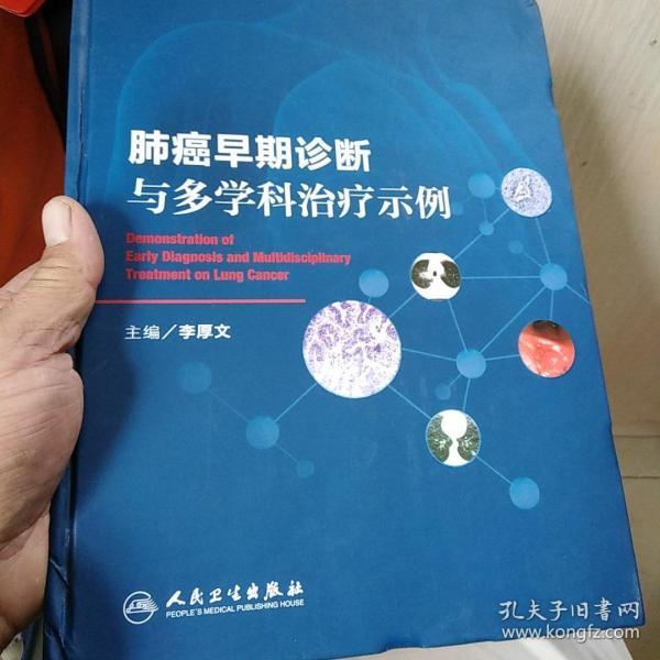 肺癌早期诊断与多学科治疗示例