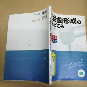 支架牙齿形成的枢纽 支台歯形成のかんどころ うまい形成下手な形成