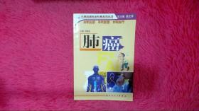 中国抗癌协会科普系列丛书·肺癌