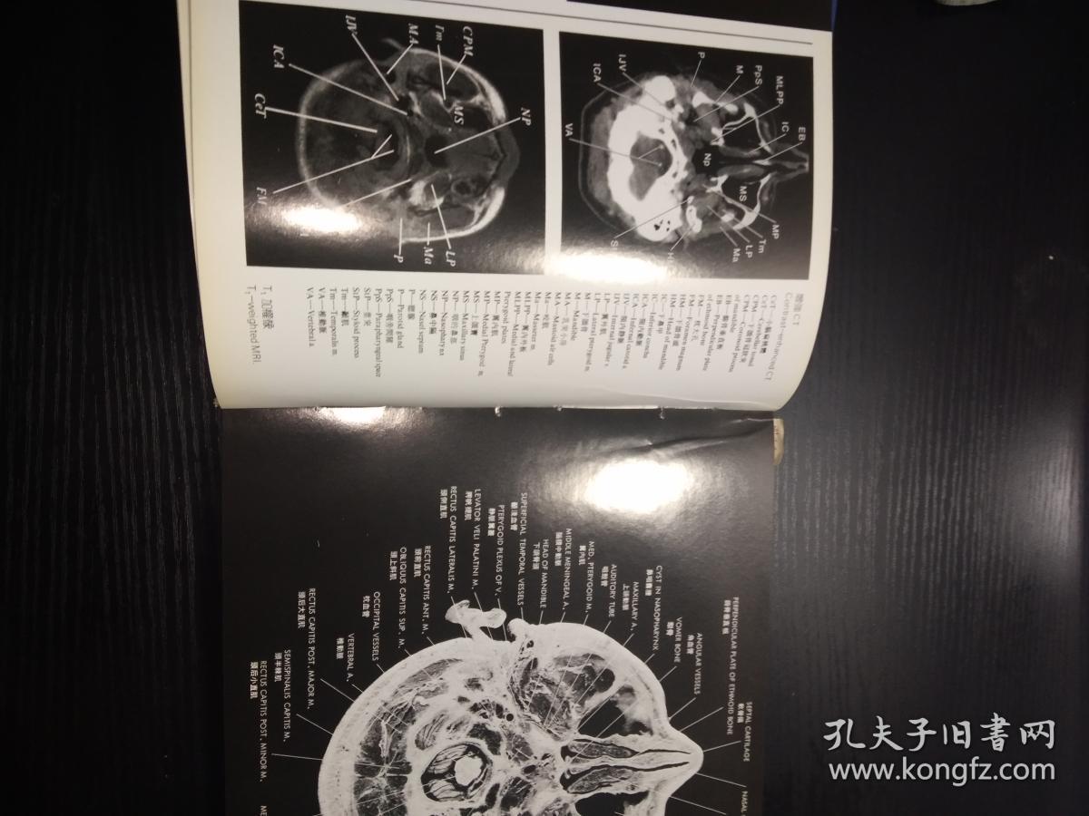 现代医学影像 MRI CT U/S与解剖断面对照图谱（横大16开精装本）