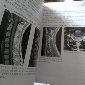 骨伤科影像读片解析一颈腰椎疾病