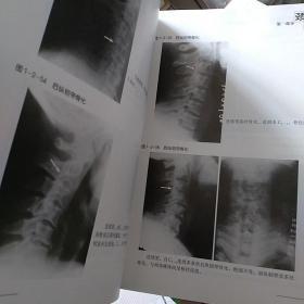 骨伤科影像读片解析一颈腰椎疾病