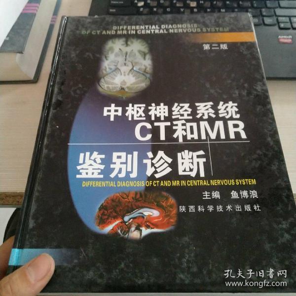 中枢神经系统CT和MR鉴别诊断