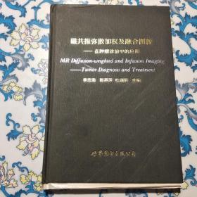 磁共振弥散加权及融合图像：在肿瘤诊治中的应用   精装本 装订偏了