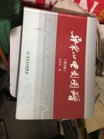 异常心电图图谱（第2版）