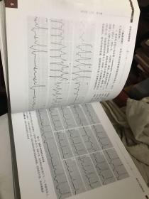 异常心电图图谱（第2版）