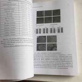 中华医学会结核病学分会2016年全国结核病学术大会论文汇编