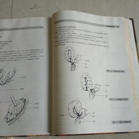 肛管大肠手术图解