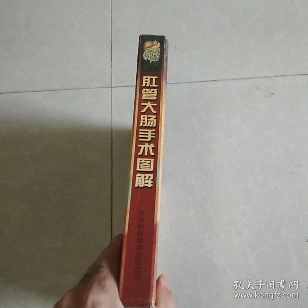 肛管大肠手术图解