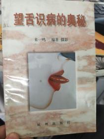 针灸治疗糖尿病