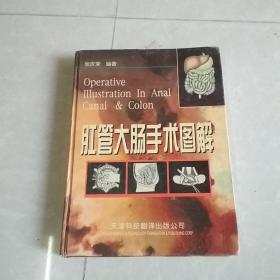 肛管大肠手术图解
