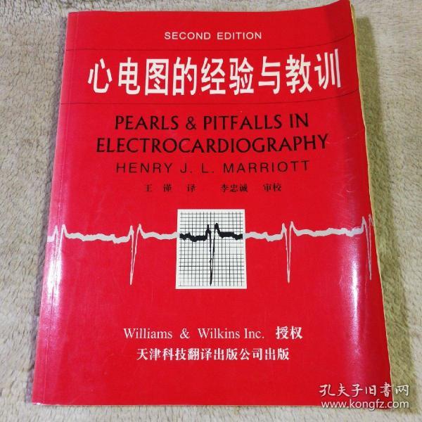 心电图的经验与教训