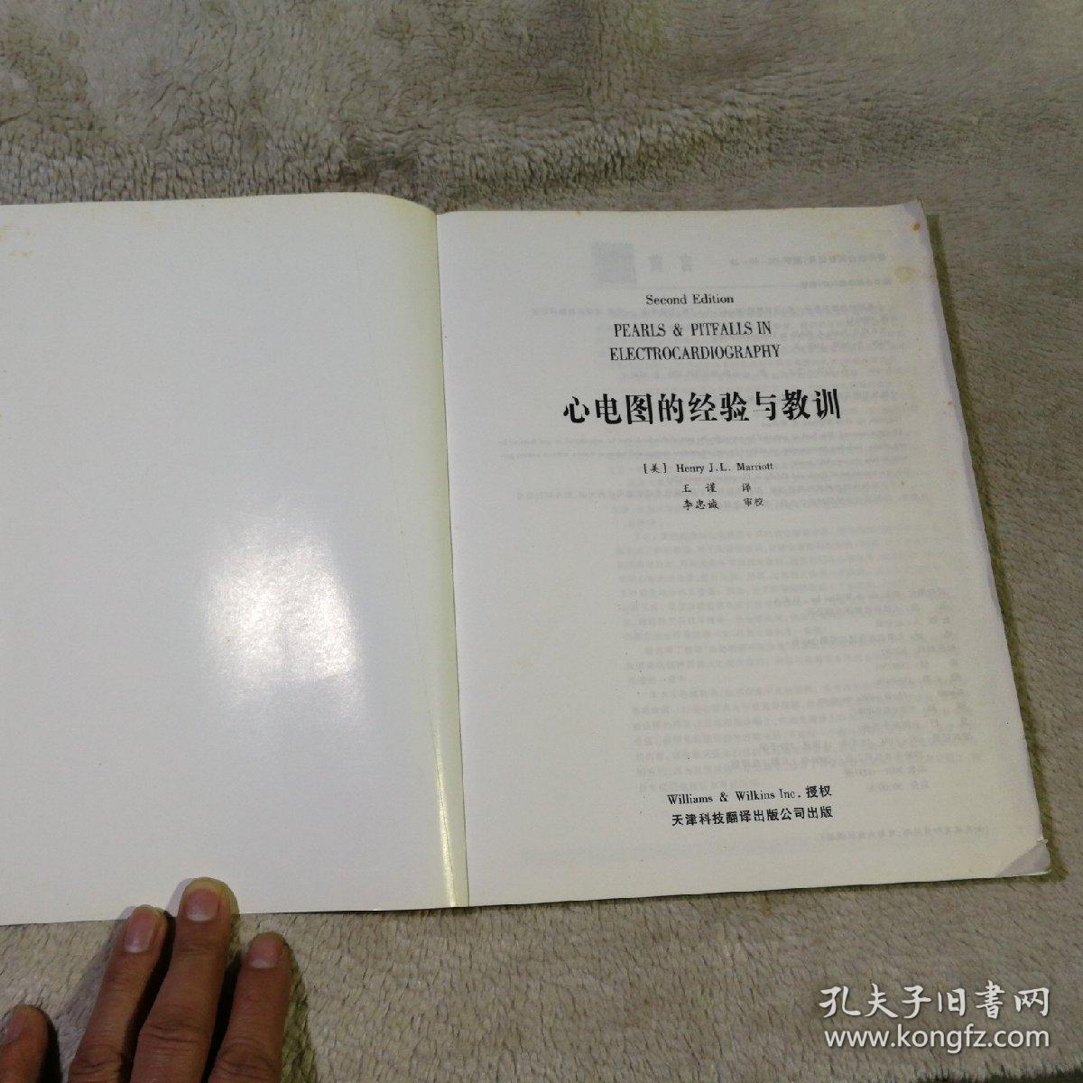 心电图的经验与教训