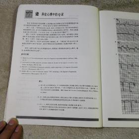 心电图的经验与教训