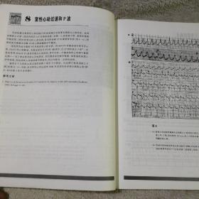 心电图的经验与教训