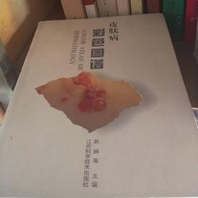 皮肤病彩色图谱