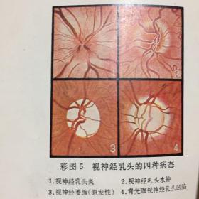 眼科手册